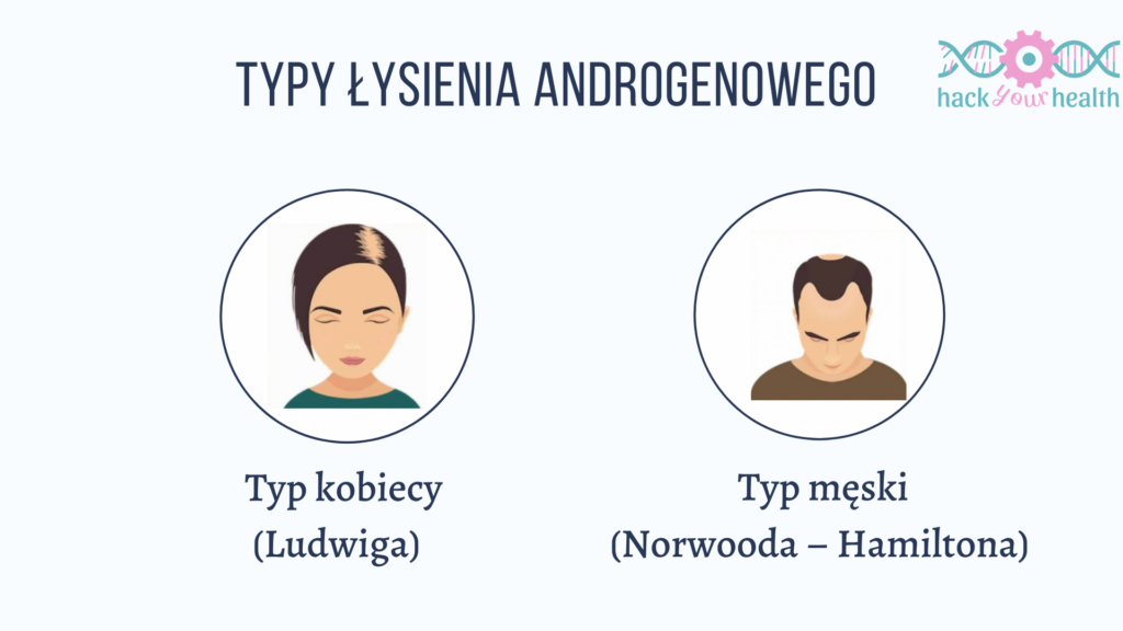 Typy łysienia androgenowego 