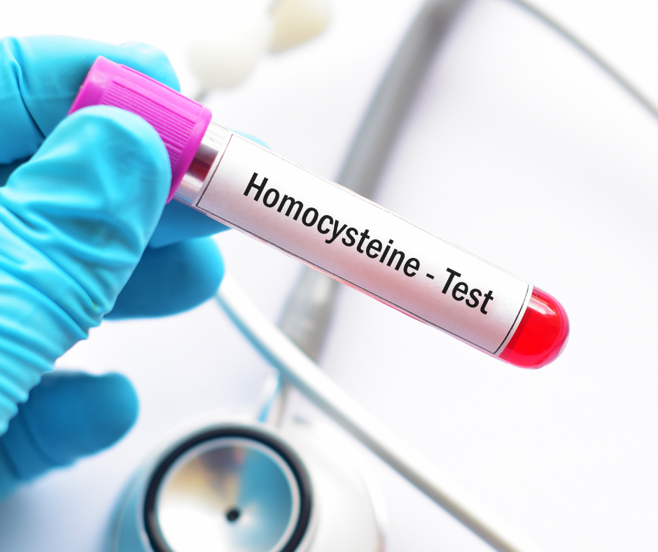 Homocysteina - czym jest? jaka jest prawidłowa norma? - Hack Your Health